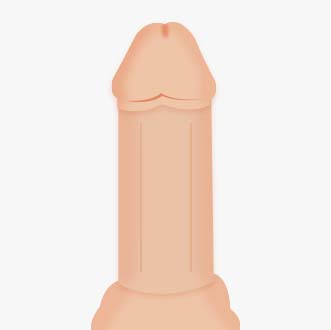 체외충격파 시술과정03